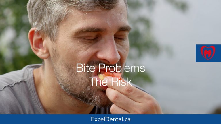 Promotional graphic of a man biting food with the text "Bite Problems The Risk" and Excel Dental branding