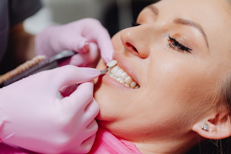 Close-up of a woman smiling during a cosmetic dental shade check with a veneer or tooth shade guide.