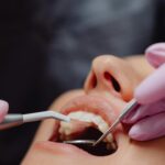 Close-up of a patient’s mouth during a dental exam with a mirror, dental tool, and gloved hands.