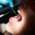 Close-up of a dental exam with a mirror and explorer inspecting a patient's teeth under bright light.