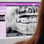 Panoramic dental x-ray displayed on a computer monitor with a person viewing the screen